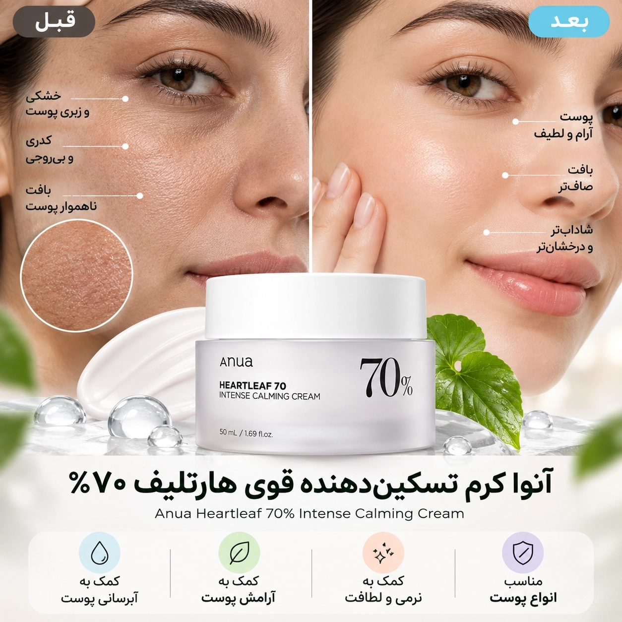 کرم Heartleaf 70 آنوا